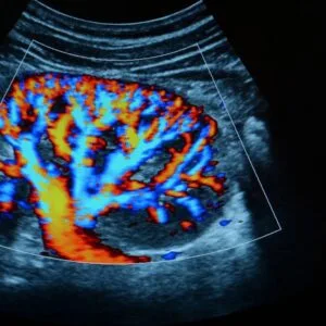 Ultrasonido Doppler
