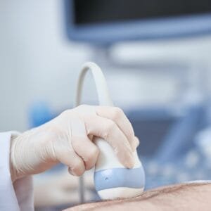 ultrasonido Doppler evaluando flujo sanguíneo en pierna