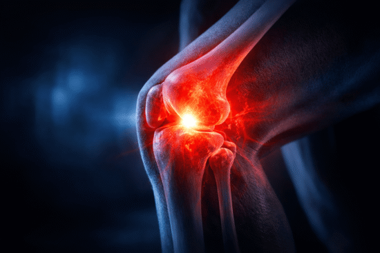 dolor de rodilla sin golpe causas inflamacion rodilla