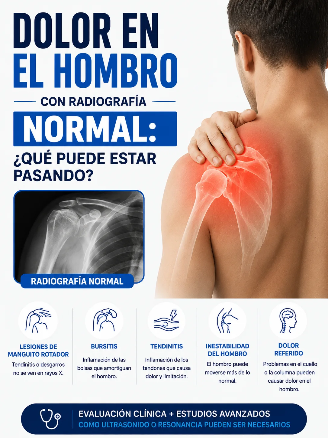 Dolor en el hombro con radiografía normal: ¿qué puede estar pasando?